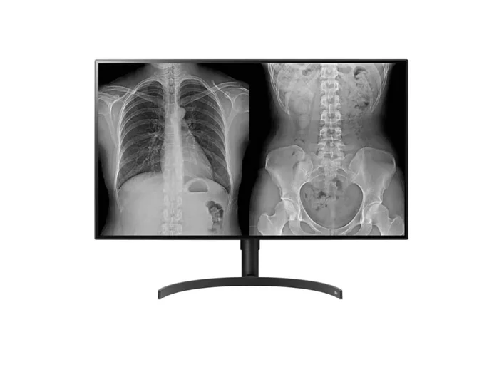 LG 32HL512D-B – 31.5” 8MP 4K Nano IPS Color Diagnostic Monitor with Multi Resolution and Clinical Pathology Modes